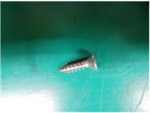 SAMSUNG WASHING MACHINE SCREW TAPPING L16 M4 - 6002-001615